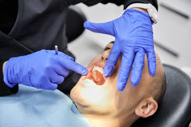 Best Emergency Dentist for Knocked-Out Tooth in Central, TN